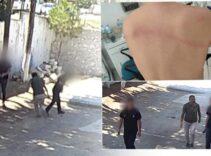 Belediye Başkanından taş döşemek istemeyen zabıta memurlarına dayak: Sırtımda sopanın izleri halen duruyor