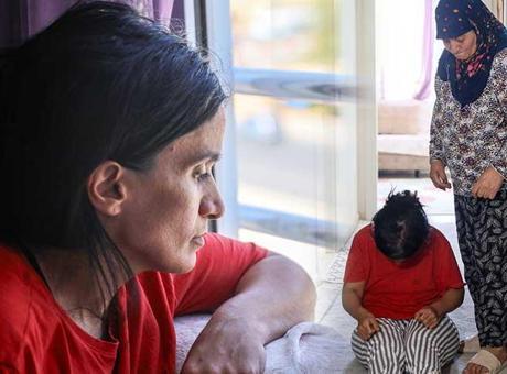 Hastalığı yüzünden evden çıkamıyor, 6 saat banyoda kalıyor! ‘Arkadaşlarım benimle alay ediyor’