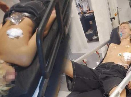 Kuşadası'nda gaspçı dehşeti! 15 yaşındaki çocuk sırtından bıçaklandı