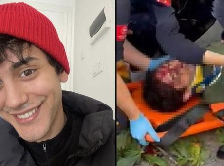 Oyuncu İbrahim Yıldız'ın üzerine ağaç devrildi! Hastaneye kaldırılan oyuncu ölüm kalım savaşı veriyor