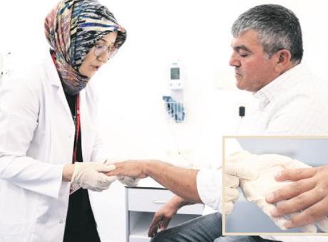 Sedef romatizmasında erken tanı kurtarıyor