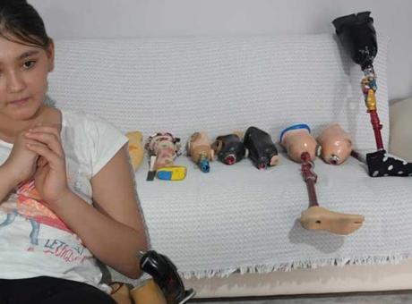 13 günlükken bacağını kaybetti! Babası 150 liralık düzenekle yürümeyi öğretti: Özge'nin büyük korkusu