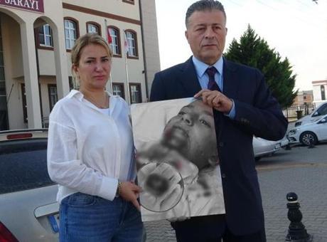Okulda korkunç olay! 7 yaşındaki Kuzey Yiğit'in demir saplanan çenesi koptu