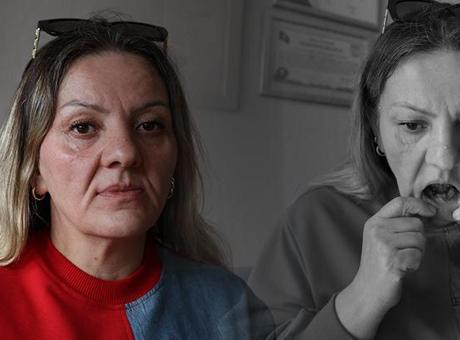 Deliller ağzında çakılı! İspatlamak için iki yıldır yemek yiyemiyor