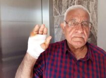 Asansörde korkunç saldırı! Komşu parmağını ısırarak kopardı: Onu çok severdim, niçin yaptı anlamadım