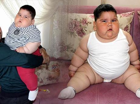 5 yaşında 90 kiloydu! 6 yıl sonra görüntülenen Yağız şaşırttı