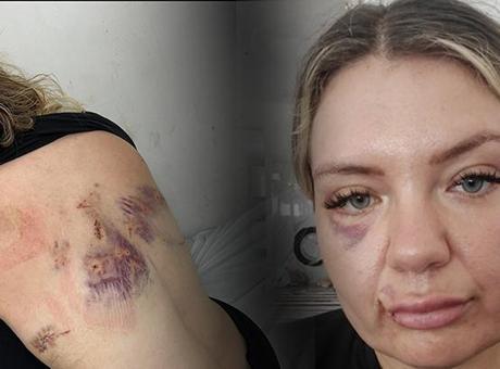 'Bugün büyük gün' diyerek aradı! Dehşeti anlattı: Şanslıydım ki bıçak sırtımda kırıldı