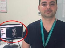 Zayıflamak uğruna kendine bunu yaptı! İstanbul'da doktorların inanamadığı vaka