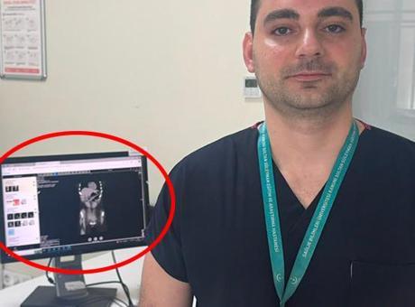 Zayıflamak uğruna kendine bunu yaptı! İstanbul'da doktorların inanamadığı vaka
